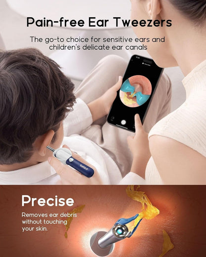 Bebird Ear Care Kit