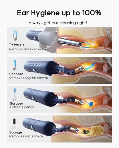 Bebird Ear Care Kit